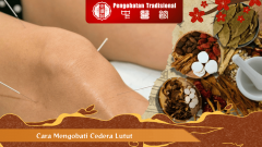 Cara Mengobati Cedera Lutut Akibat Benturan dengan TCM yang