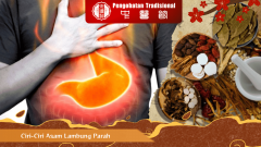 Begini Ciri-Ciri Asam Lambung Parah dan Perlu Diwaspadai
