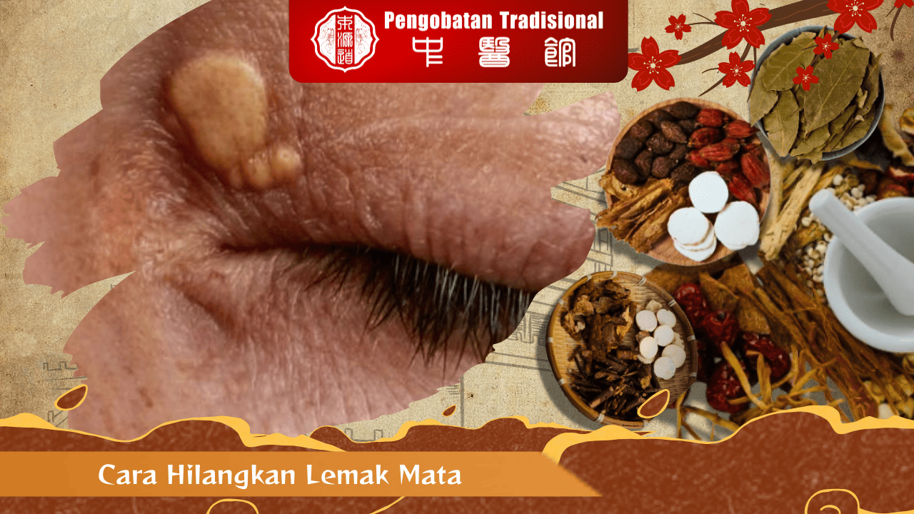 Cara Hilangkan Lemak Mata dengan Alami