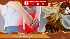 Mari Kita Mengetahui Tentang Penyakit Hemoroid