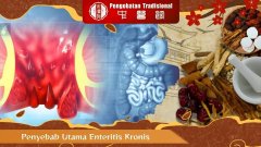 Penyebab Utama Enteritis Kronis dan Cara Mencegahnya