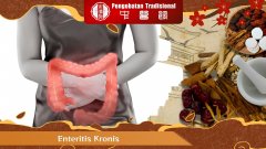 Enteritis Kronis? Coba Obat Herbal Ini!