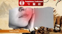 Gejala Parotitis yang Sering Diabaikan dan Komplikasinya