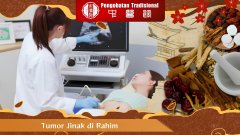 Tumor Jinak di Rahim: Fakta Seputar Fibroid