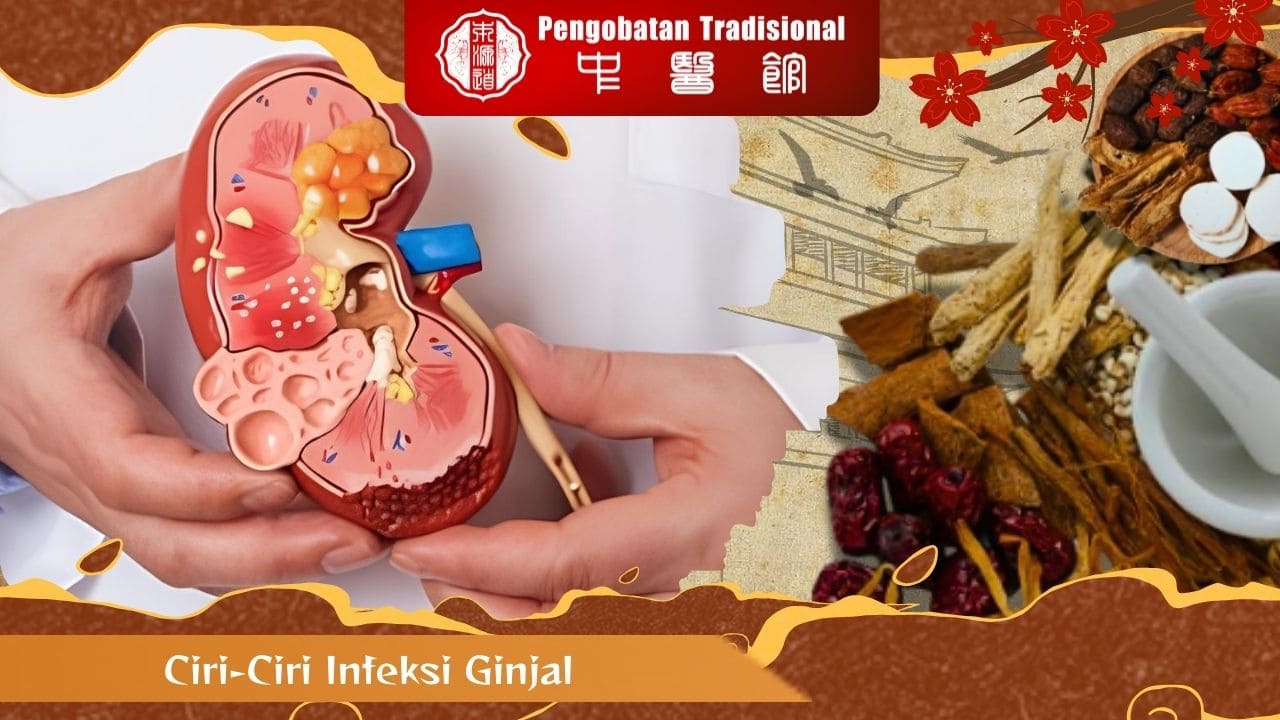 Begini Ciri-Ciri Infeksi Ginjal yang Susah Parah